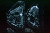 mri_m[2]